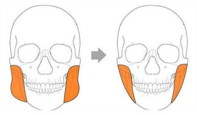 大方脸怎么靠微调改善脸型,改善脸型脸宽