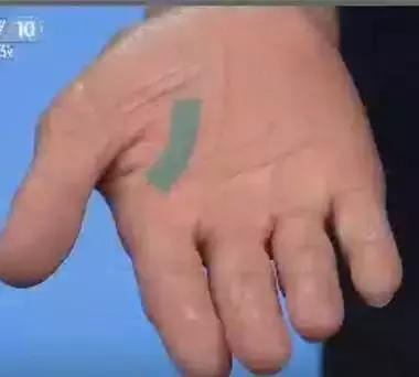 手诊10种常见病从手上就能看出来,如何辨别手掌的健康