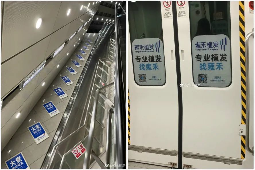 植发市场现状,植发市场快速增长