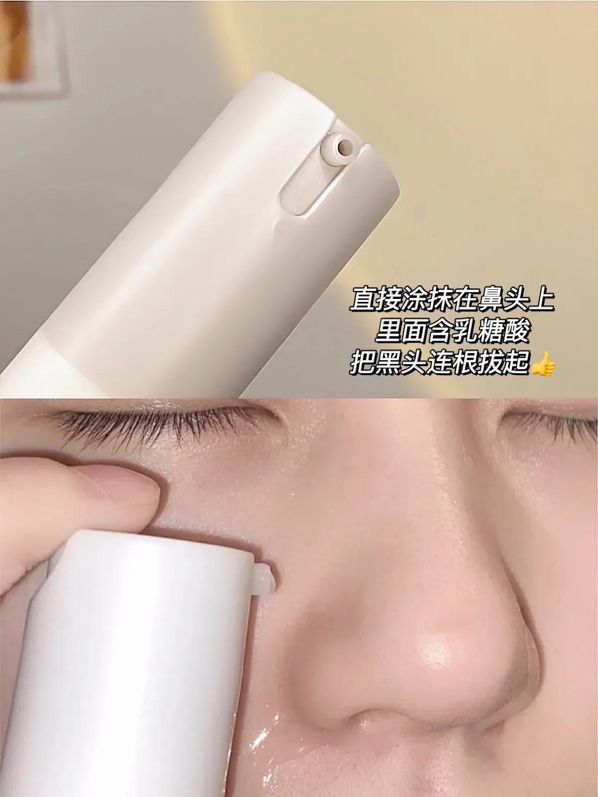 黑头终结者！攒了15年黑头连根拔起，鼻子比钱包还干净