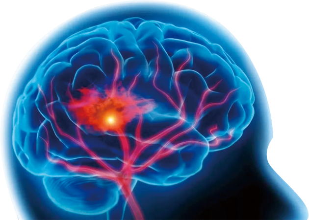 轻中度急性缺血性脑卒中,缺血性脑卒中双抗治疗