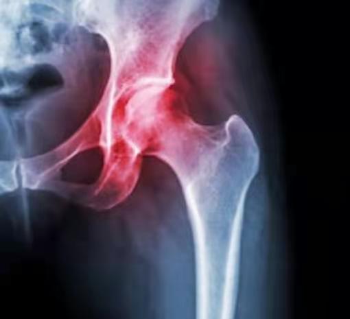 弯腰听到髋骨头咯噔一声,盆骨与腰骨连接处咯咯响什么问题