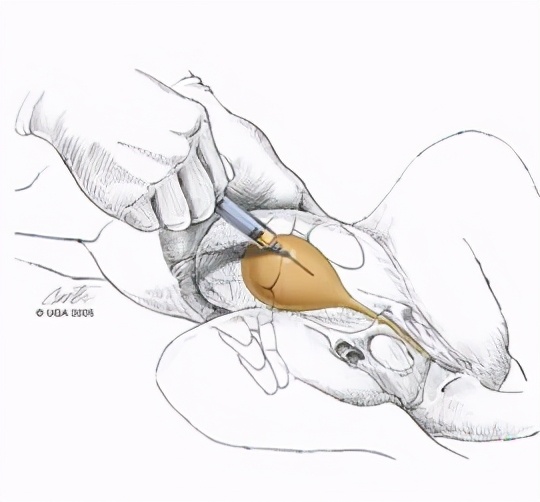 男言之隐怎么样,男言之隐介绍