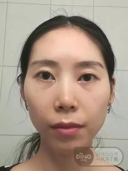 圆胸要怎样改善,小胸平胸选什么样的罩杯显大