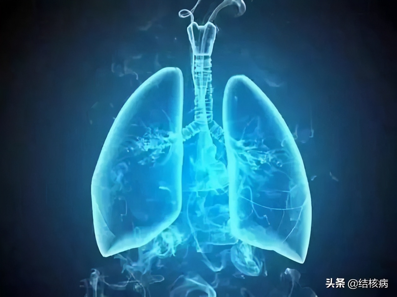 肺结核治疗期间为什么还是咳痰呢,治疗肺结核要多长时间才能有效