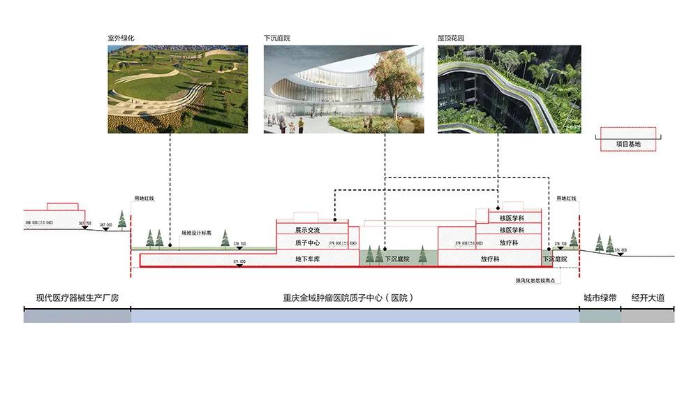 重庆全域肿瘤医院质子获批,医院质子中心建设过程
