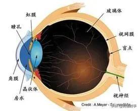 专家谈老年飞蚊症的治疗,飞蚊症老年人