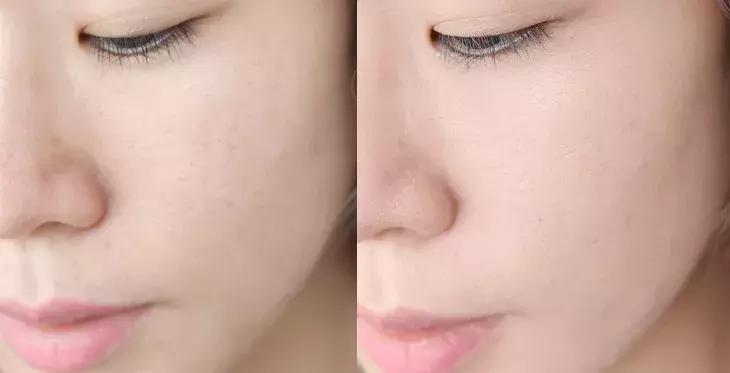 十大公认好用的气垫干皮不卡粉,气垫遮瑕持久不脱油皮妆第一名