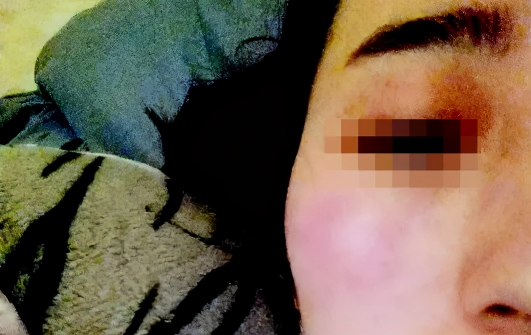 青岛华韩整形医院违法吗,青岛华韩整形医院事故