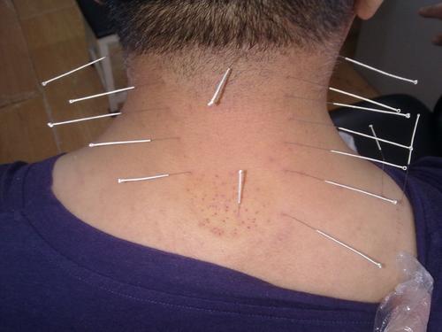 反复出现头晕吃什么药管用,一直反复头晕是怎么回事会不会死