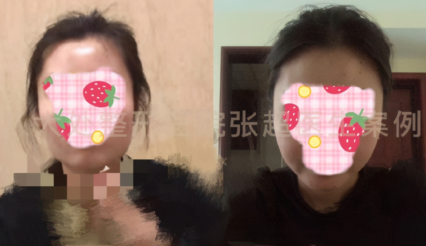 八大处张超抖音,八大处张超合集