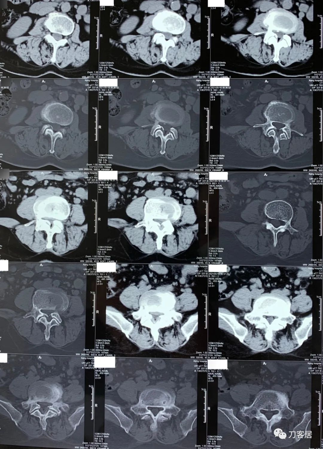 我的门诊病历,我的门诊