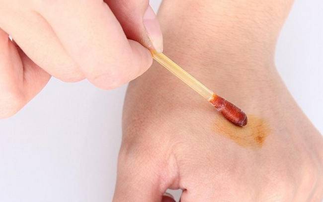 创可贴不能贴什么伤口,宝宝伤口可以贴创可贴吗