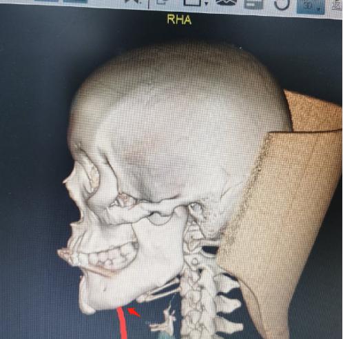整形医生如何提高审美,十年前的整形审美和现在的审美