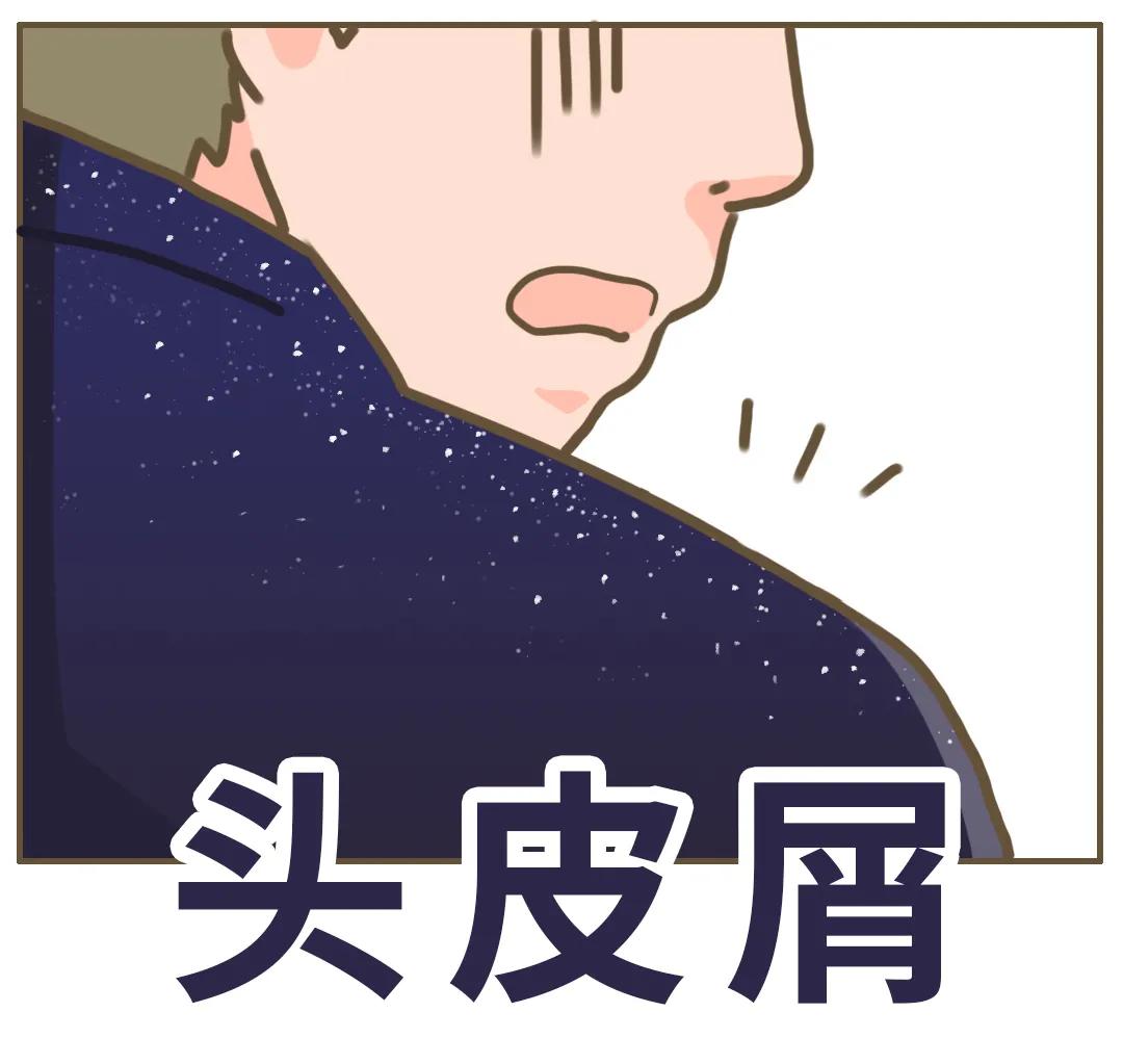 冬天为什么会有头皮屑,为什么头皮屑越挠越多