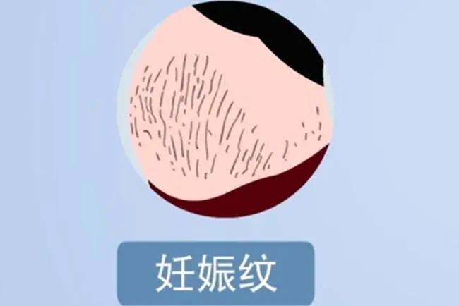 孕期皮肤保养法,孕期保养皮肤最好的方法