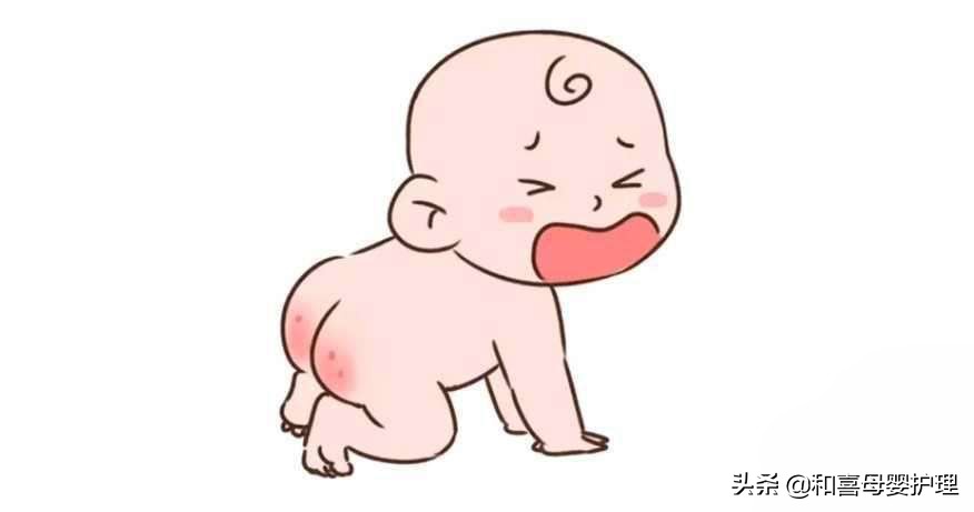 宝宝红屁股最有效的方法,宝宝红屁股了怎么弄好得快