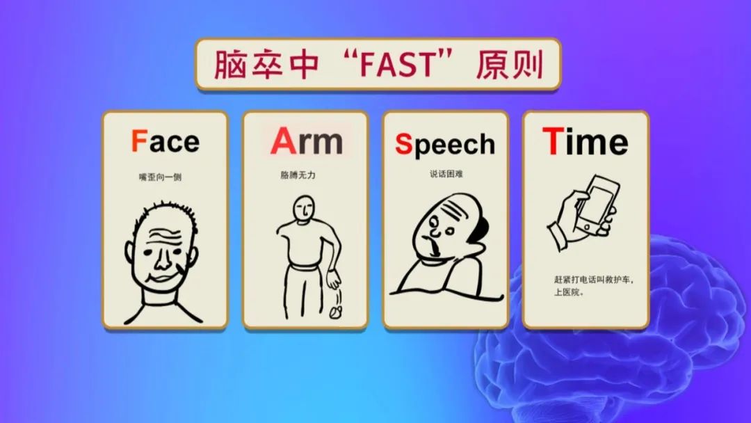 脑中风的急救口诀大全,脑中风前兆及应急措施动画