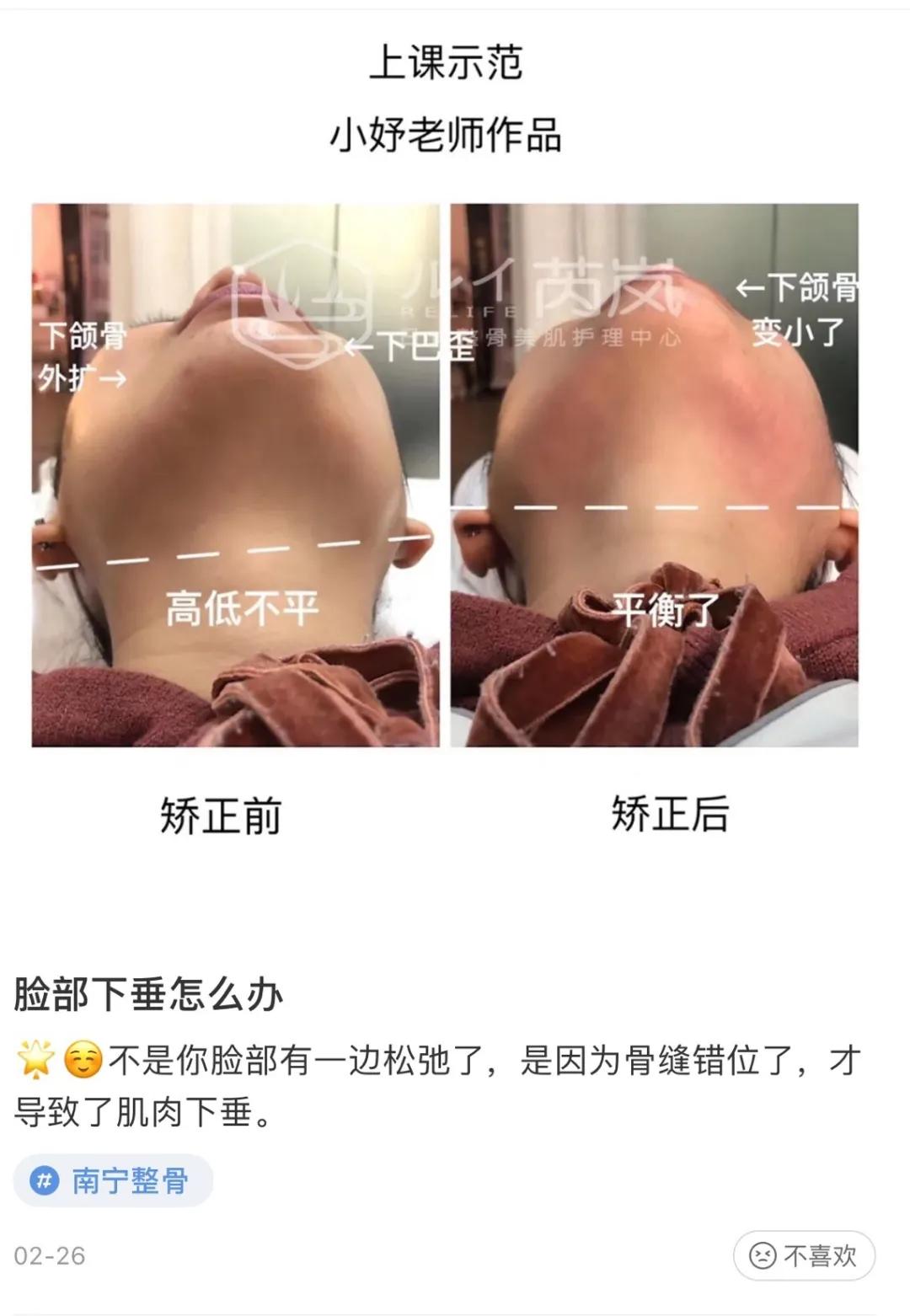 奇奇怪怪的护肤方法其实挺坑的,这些神奇的护肤手法