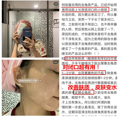 孙艺珍的颜值变化,孙艺珍颜值巅峰的笑容