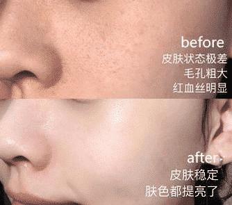 张韶涵沉浸式护肤的护肤品名称,张韶涵护肤用的产品