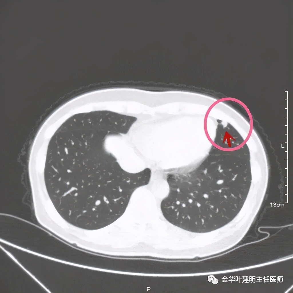 放个大招完整版教学,放个大招完整版前奏