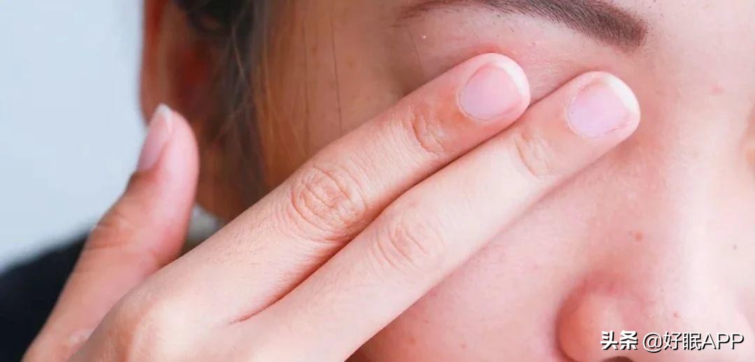 早起眼睛水肿怎么快速消肿,早起眼睑水肿可以中药调理吗