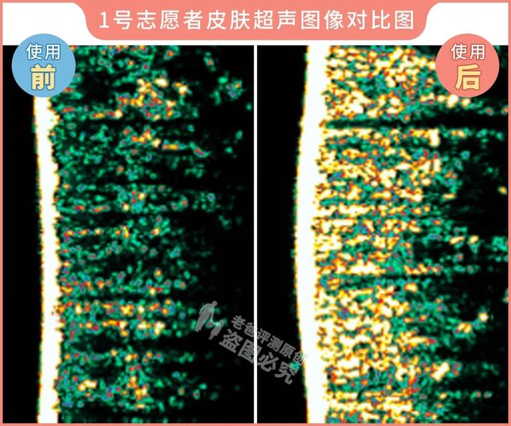 300块的网红美容仪有效果吗,网红家用美容仪测评