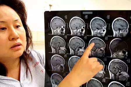 入侵物种，非洲大蜗牛，专家建议最好不要触碰，更不要食用