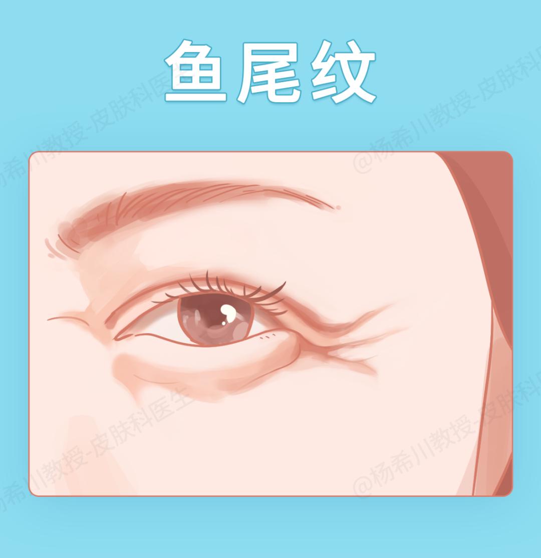 打除皱针没效果是什么原因,打除皱针不成功案例