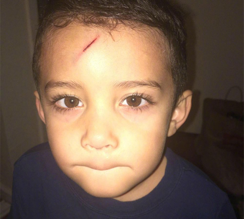 萌娃不小心撞到脑袋摔了一跤,萌娃不小心撞到脑袋摔一跤