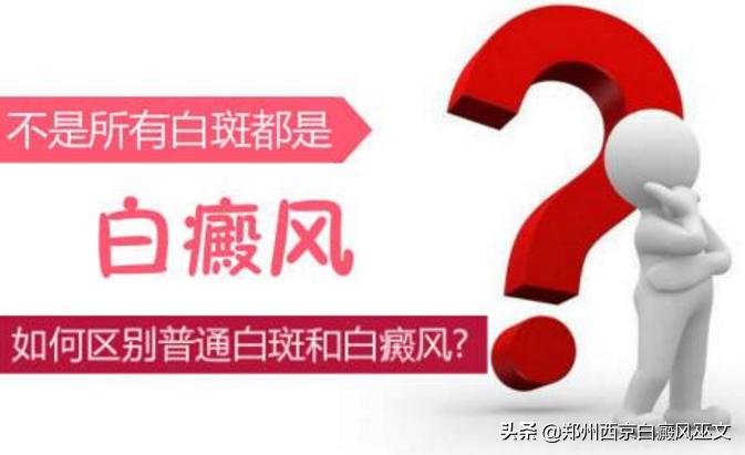 小儿白癜风高发怎么办,2岁儿童怎么确诊白癜风最准确