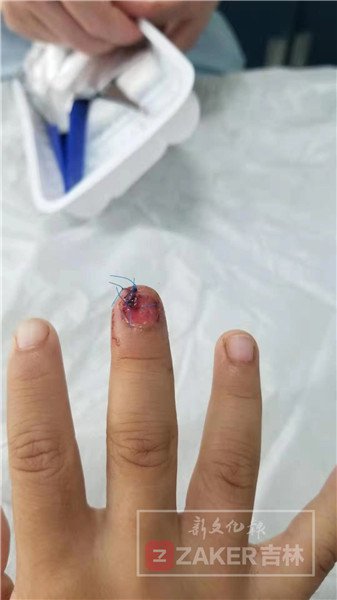 在小区游乐场小孩玩耍受伤,小孩在社区玩受伤家长要求赔偿