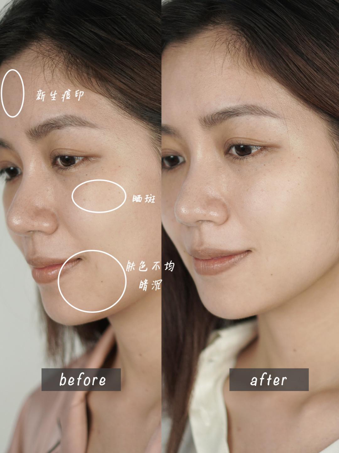 小灯泡与科颜氏淡斑测评,科颜氏去黄提亮效果怎么样