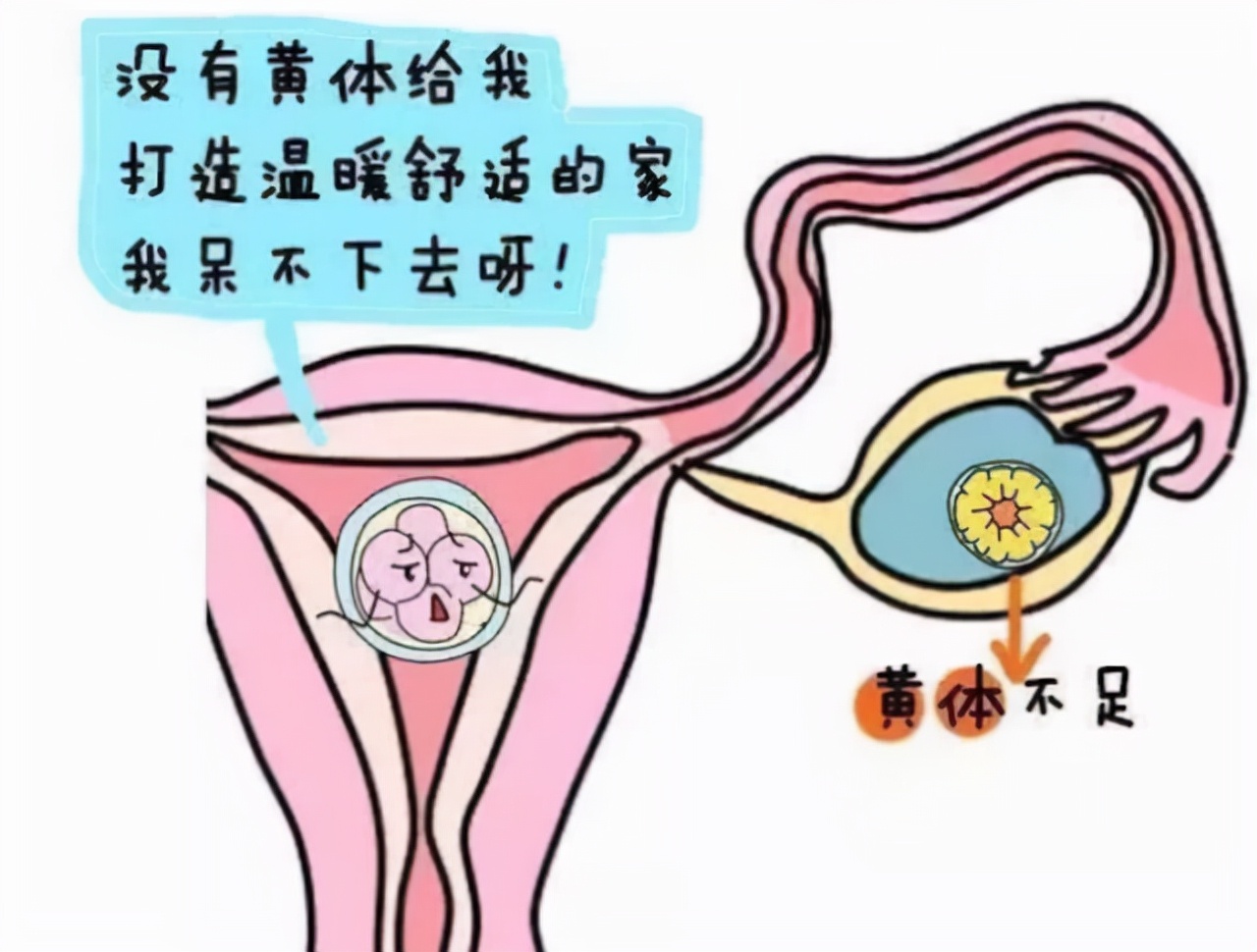 一天接了3个急诊,都是黄体破裂,黄体到底是什么?女性请了解下