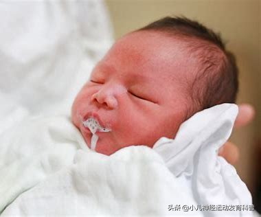 婴儿呕吐是啥引起的,婴儿溢奶的症状