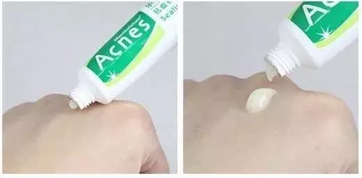 中国战痘神器,终极战痘神器视频