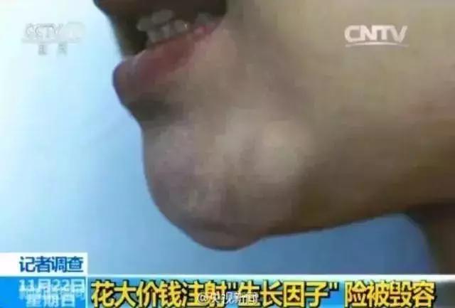 「辟谣+科普」EGF修复原液/EGF*干粉冻**不能买了吗？