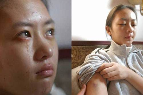 当年张默打童瑶的事,张默打童瑶后被判刑了吗