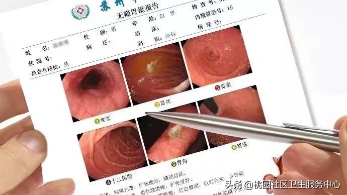 手把手教你：3分钟看懂胃镜报告