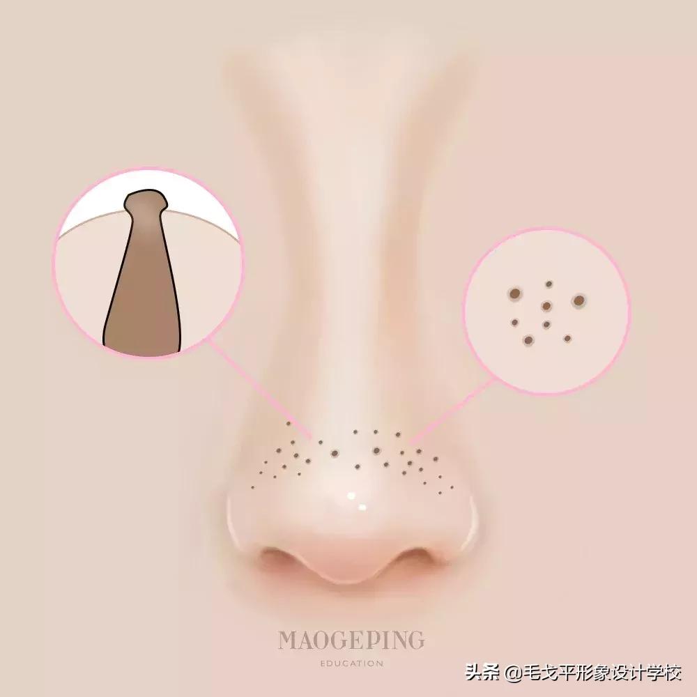 如何去黑头最快最有效的方法,科颜氏白泥去黑头正确使用方法