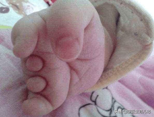 见红保胎的正确方法,29周保胎见红还能继续保胎吗