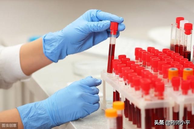 长白斑是白癜风吗,长白癜风