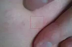 新生儿皮肤问题怎么解决,家有新生儿怎么办