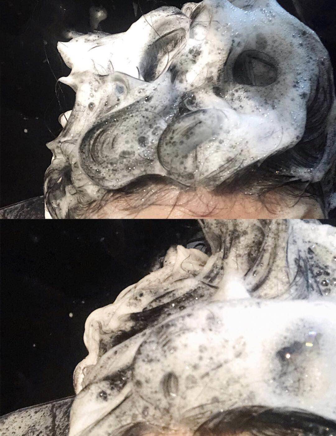 为什么换季会脱发,秋冬季怎么脱发这么严重