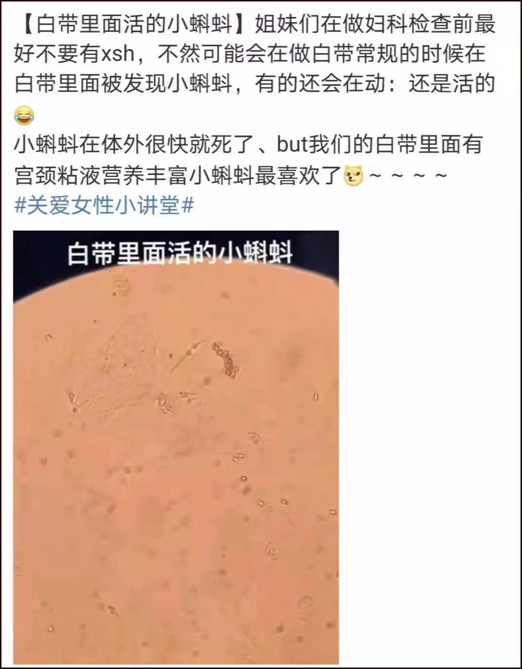第一次去妇科检查需要注意什么,第一次产检妇科检查都有哪些项目