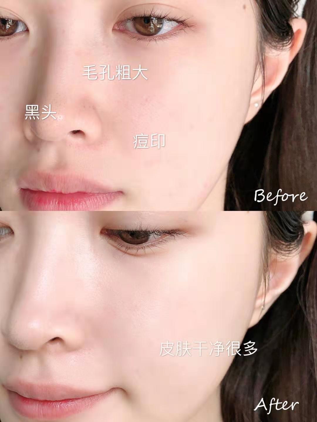 混油敏感肌肤日常怎么护肤,三十岁混油敏感肌护肤产品