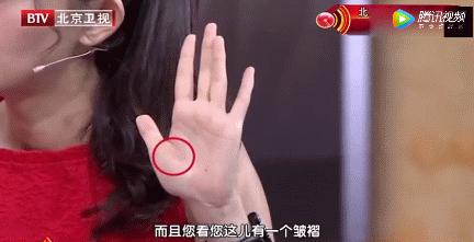 洗澡后手上的青筋暴露是什么原因,今天手上突然冒青筋是怎么回事啊