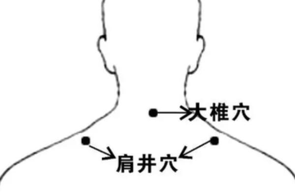 艾灸哪个穴位治疗湿疹最有效,耳朵里有湿疹可以按哪些穴位