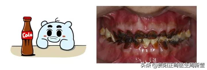 牙疼淋巴肿大是什么原因引起的,牙疼白天不疼晚上疼是什么原因